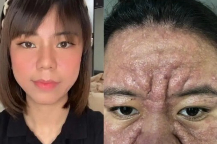 Kisah Viral Farah! Hormon Kehamilan yang Bikin Wajah Berubah, Aksi Suaminya Banjir Pujian