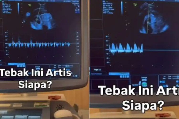 Siapa Siti Sintawati? Intip Profil dan Biodatanya Lengkap Di Sini, Ternyata Bukan Orang Sembarangan